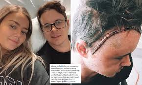 As it grows like a web through the brain, it is almost impossible to remove by surgery alone and is often. Former Home And Away Star Johnny Ruffo 32 Reveals His Brain Cancer Has Returned Again Daily Mail Online
