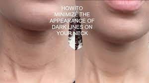 conceal dark lines on your neck