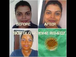 instant skin glow home remes in