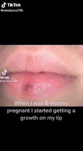 lip while pregnant