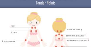 Fibromyalgia Tender Points What And Where Are The Tender