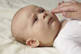 baby acne neonatal acne definition