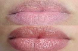 permanent lip color treatment in