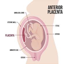 anterior placenta what it means for