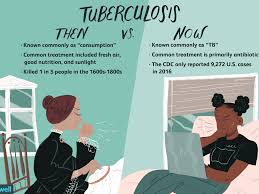 Tuberculosis (tb) is caused by bacteria (mycobacterium tuberculosis) that most often affect the lungs. Tuberculosis Tb Overview And More