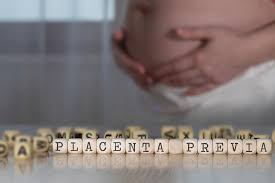 What are the types of placenta previa? Placenta Previa Causes Risk Treatment