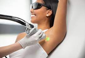is laser hair removal the best hair