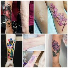 30 ideias de tatuagens para quem possui cicatrizes. Tatuagem Em Cicatriz 70 Melhores Tattoos Para Cobrir Cicatriz Com Estilo