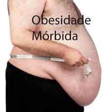 Resultado de imagem para imagem obesidade morbida