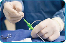 Image result for Catheter Procedures
