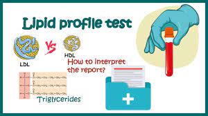lipid profile test how to read report