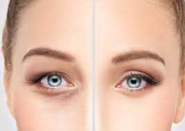 eyelid fat removal the eyelid insute