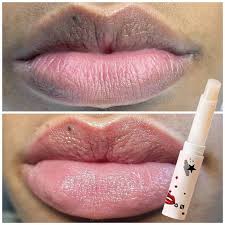 lip balm to remove dark lips natural