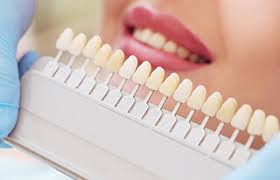 Dental Implants Restorative Dentistry Devonshire Dental