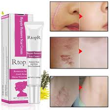 acne scar stretch marks remover cream