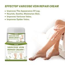 50g varicose veins treatment cream