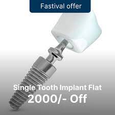 cost of dental implants in india