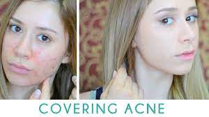 how to cover acne without looking cakey