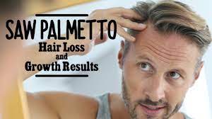 Saw palmetto has proven effects in treating both male and female pattern baldness. Saw Palmetto Hair Loss Growth Results Youtube