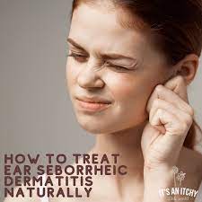 how to treat ear seborrheic dermais