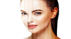 Uneven Skin Tone on Face - Causes & Removal Tips