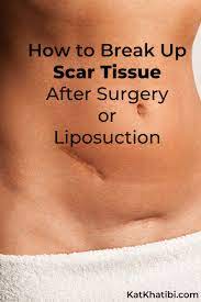 break up scar tissue after surgery