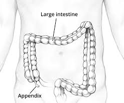 definition facts for appendicitis niddk