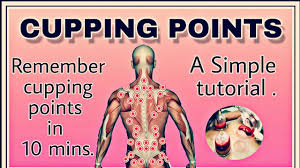 Cupping Points Hijama Points Youtube