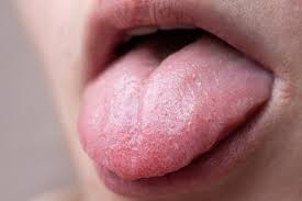 ps on tongue 10 common causes