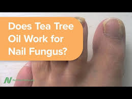 does tea tree oil work for nail fungus