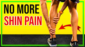 running with shin splints is it ok to