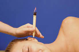 letter of recommendation ear candling