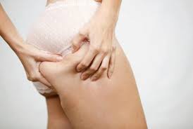 how to hide stretch marks and cellulite