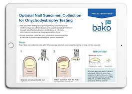optimal nail specimen collection