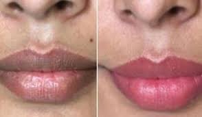 pink lips with these simple home remes