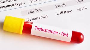 age affect free testosterone levels