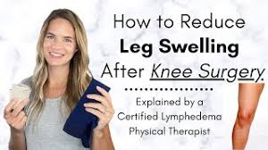 reduce leg swelling after knee surgery