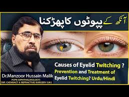 causes of eyelid twitching prevent