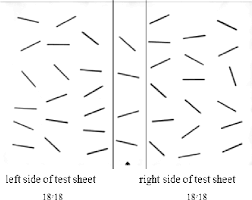 Bit behavioral subtest (bitb) consists of 9 items: Line Bisection Test Printable Left Neglect After Stroke Definition Treatment Exercises The Mean Percentage Of Deviation From The Middle Is Then Calculated And Compared With Normative Data
