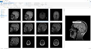 The dicom image viewer window is manually adjustable and a series of multiple images can be played in loop. Microdicom Free Dicom Viewer And Software
