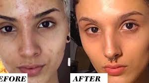 this woman s before and after retinol