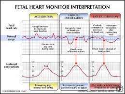 Fetal Heart Monitor Interpretation Child Nursing Ob
