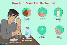 do burn scars go away