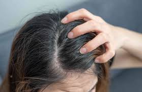 itchy scalp causes treatment and