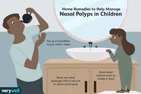 nasal polyps in children