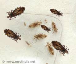 home remes for louse head lice