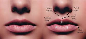 lip injection austin lip fillers for