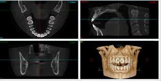 why we use cone beam cbct for