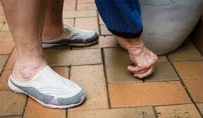 feet and toenails of the elderly