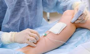 Most insurers will ask to review the results of a venous ultrasound before covering treatments for varicose veins. Varicose Veins Spider Veins Treatment Removal Amita Health Chicago Il